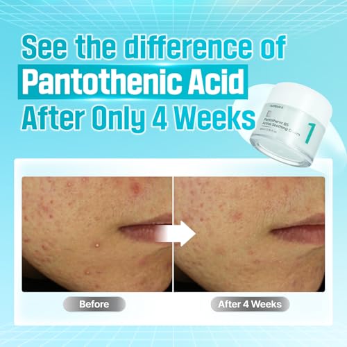 numbuzin No.1 Cream | Pantothenic B5 Active Soothing Cream | Lightweight Hydrating Moisturizer, Pantothenic Acid, Niacinamide, Panthenol | Excess Oil Control, Soothes Acne | Non-Comedogenic | 80ml