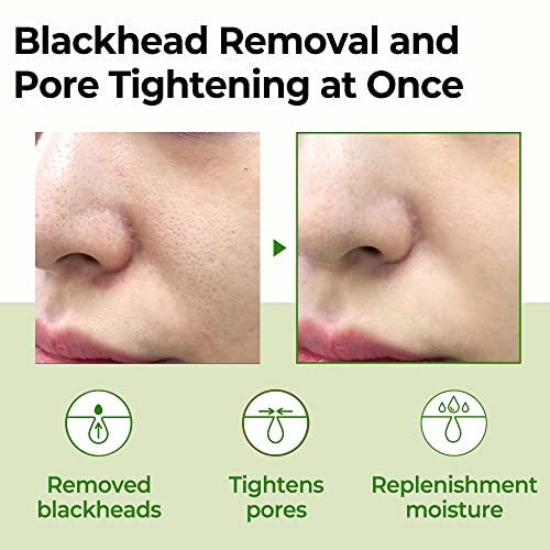 Some By Mi Super Matcha Pore Tightening Toner, 150 gm
