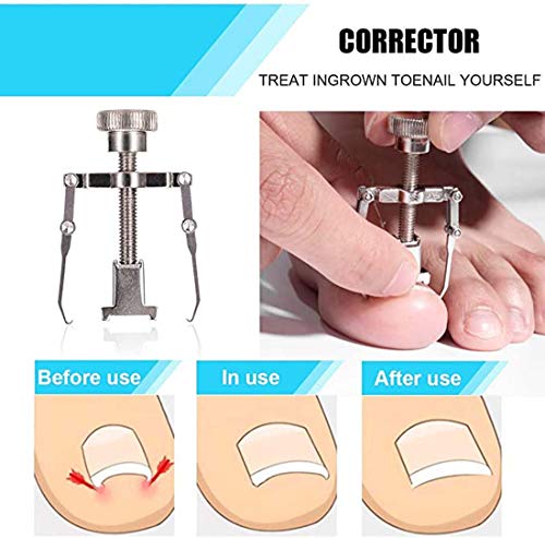 ELECDON Toenail Clippers Set 7Pcs, Staineless Steel Ingrown Toenail Tool Kit, Professional Toe Nail Nippers Set Pedicure Treatment Tool for Ingrown & Thick Nail, Surgery Grade Manicure Pedicure Tool
