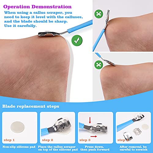 AMEILOZ 23 in 1 Professional Pedicure Tools Stainless Steel Foot Care and Nail Tools Set, Blue