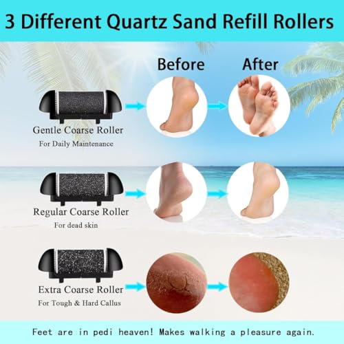 Bixbite 18 Pcs Foot Scrubber for Dead Skin, Get Smooth Feet at Home with Electric Callus Remover for Feet, Rechargeable Electric Foot Callus Remover for Cracked Heels, 30+ Foot Scrub Salon Procedures
