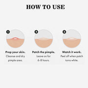 ABC Acne Pimple Patch for Face (108 dots) | Waterproof Patches for Active Acne | Absorbs Pimple Overnight and Reduces Excess Oil | Facial Patches with 100% Hydrocolloid