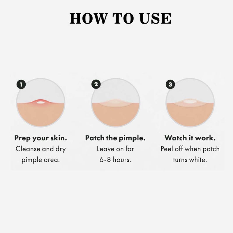 ABC Acne Pimple Patch for Face (108 dots) | Waterproof Patches for Active Acne | Absorbs Pimple Overnight and Reduces Excess Oil | Facial Patches with 100% Hydrocolloid