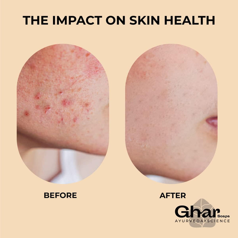 Ghar Soaps Face Hand Clean Towels | India's 1ST Disposable Face Towel |Gym & makeup remover | Towels for Facewash Sport Travel Ultra Soft | Biodegradable | Cruelty free | Vegan|