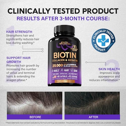 Biotin | Collagen | Keratin | Hyaluronic Acid - Hair Growth Support Supplement | Skin & Nails Beauty Complex 25000 mcg - B1 | B2 | B3 | B6 | B7 - Made in USA - For Women & Men | 60 Capsules