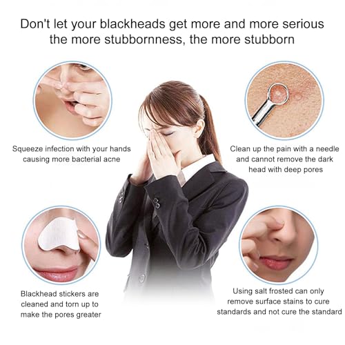Black Head Remover for Nose, Electric Adjustable Pimple Extractor, Skin-Friendly Facial Skin Care Products, Beauty Tools & Accessories for Women, Men, Adult