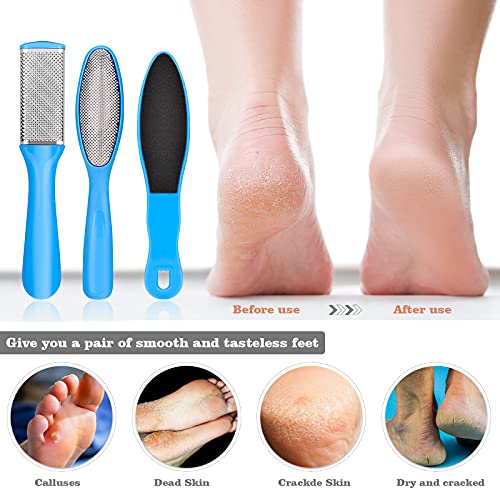 AMEILOZ 23 in 1 Professional Pedicure Tools Stainless Steel Foot Care and Nail Tools Set, Blue
