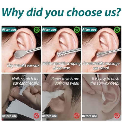 6 In 1 Ear Cleansing Tool Set, Ear Wax Removal Kit, Ear Pick, Stainless Steel, Spiral Design, Reusable with Storage Box, Safely, Gently, Ear Cleaner for Kids and Adults, Ear Wax Buildup (Black)