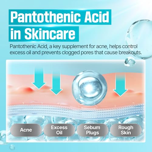 numbuzin No.1 Cream | Pantothenic B5 Active Soothing Cream | Lightweight Hydrating Moisturizer, Pantothenic Acid, Niacinamide, Panthenol | Excess Oil Control, Soothes Acne | Non-Comedogenic | 80ml