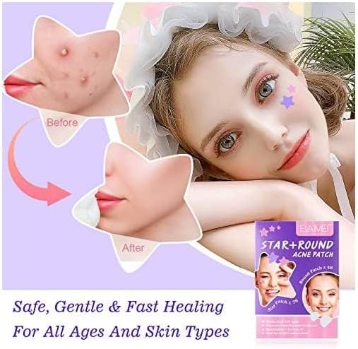 KANZA - 30 Pcs T-Zone Hydrocolloid Patches| Cleansing Blackhead Remover| Acne Patch Pimple Remover for Zit Breakouts |Nose and Forehead Patch |Painless,Safe |Removes Pimple,Acne Nose Gunk Pores