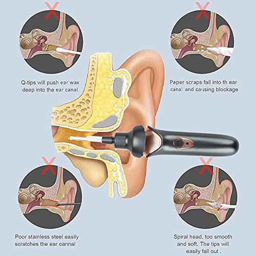 X spring Xspring Ear Wax Remover Vacuum Cleaner, Ear Vacuum with LED Light, Electric Earwax Removal Kit, USB Charge Reusable Safe Electric Ear Suction, Earwax Cleaner for Adults Kids (Black)