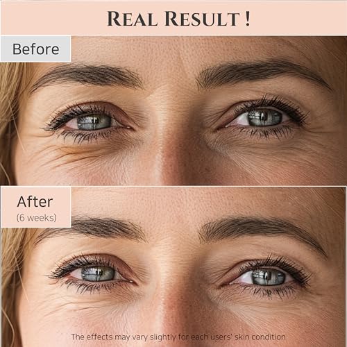 Beauty of Joseon Revive Eye Serum with Retinal Niacinamide Peptide Correction for Puffy Eye Bags Fine Lines Dark Circles Wrinkles, Korean Skin Care 30ml, 1 fl.oz