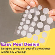 KANZA - 30 Pcs T-Zone Hydrocolloid Patches| Cleansing Blackhead Remover| Acne Patch Pimple Remover for Zit Breakouts |Nose and Forehead Patch |Painless,Safe |Removes Pimple,Acne Nose Gunk Pores