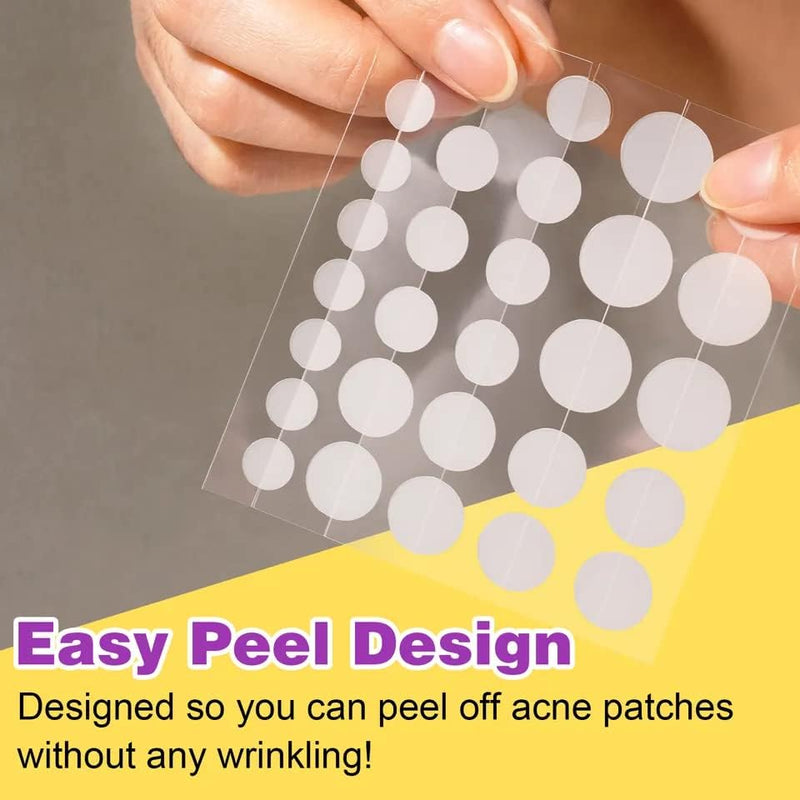 KANZA - 30 Pcs T-Zone Hydrocolloid Patches| Cleansing Blackhead Remover| Acne Patch Pimple Remover for Zit Breakouts |Nose and Forehead Patch |Painless,Safe |Removes Pimple,Acne Nose Gunk Pores