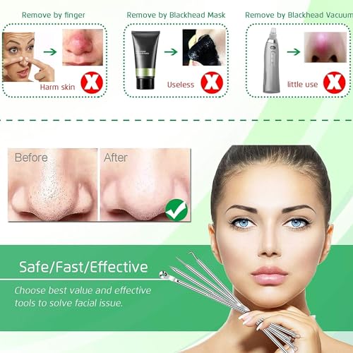 6 PCS Blackhead Remover Comedone Extractor Acne Needle Tools Set Professional Stainless Blackhead Tweezer Kit Removing Whitehead Popping Zit for Nose Face Skin Blemish Treatment Pimple Popper Tool Kit