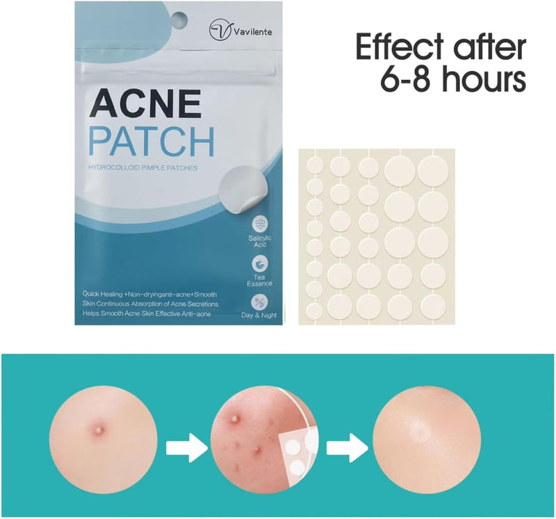 Vavilente Acne Pimple Patch,Hydrocolloid Patches for Covering Zits and Blemishes,Korean Pimple Patches for Face Zit Dots Tea Tree, Calendula Oil,Microdart Acne Patches(210 Count)
