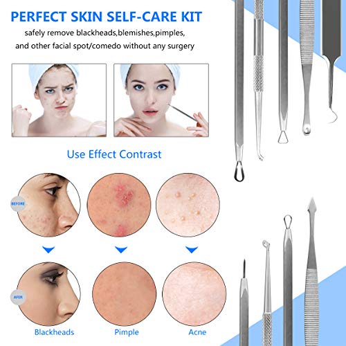 STWIE 10PCS Blackhead Remover Tools Kits + Ear Wax Removal Tools +Cuticle Pusher Remover Kit,10PCS Remover Tools Professional Pimple Comedone Extractor Zit Popper Tool Kit