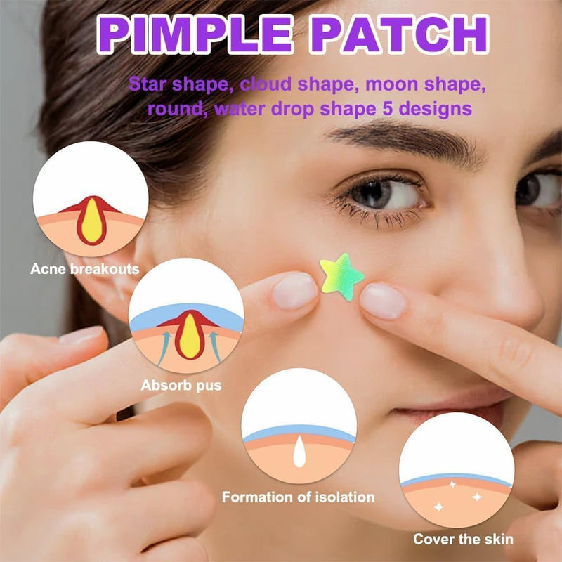 Azonee Pimple Patches for Face, Hydrocolloid Acne Patches Cute Star Zit Covers Spot Cover Stickers 180 Pcs with Tea Tree Salicylic Acid Natural Green Algae Extract Blemish Spot Stickers, 5 Styles