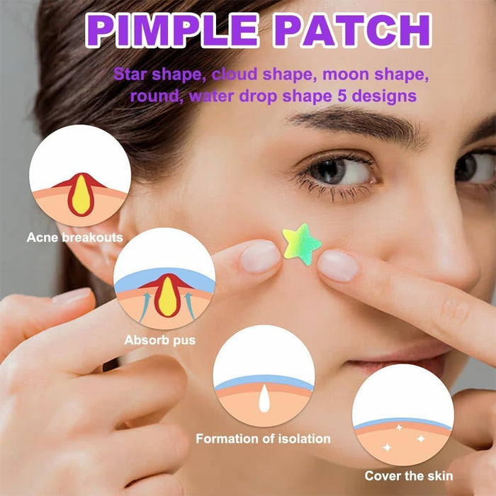 Azonee Pimple Patches for Face, Hydrocolloid Acne Patches Cute Star Zit Covers Spot Cover Stickers 180 Pcs with Tea Tree Salicylic Acid Natural Green Algae Extract Blemish Spot Stickers, 5 Styles