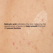 Salicylic Acid 0.5% Body Serum (240ml) Exfoliating Treatment for Softening Rough, Bumpy Skin and Refining Texture from Neck to Toe