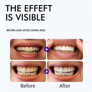 Purple Teeth Whitening Strips, 28Strips Gentle Daily Purple Whitening Strips for Surface Stain Reduction & Natural Shine, Portable Teeth Care Strips, Advanced Fast-Acting Teeth Whitening Strip