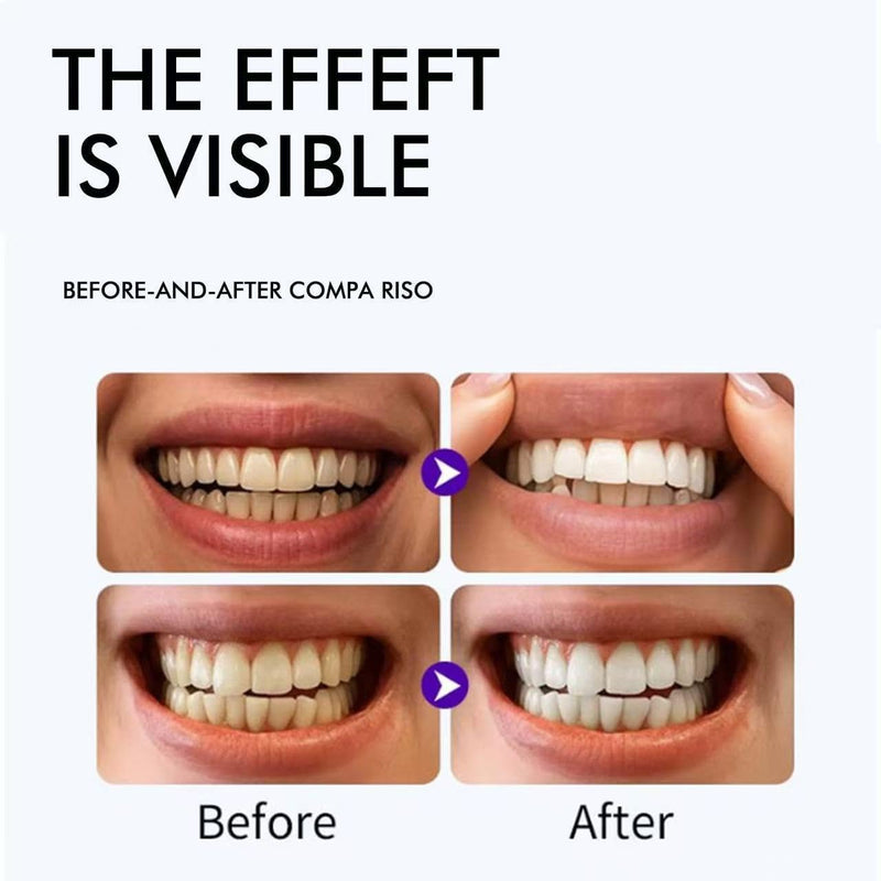 Purple Teeth Whitening Strips, 28Strips Gentle Daily Purple Whitening Strips for Surface Stain Reduction & Natural Shine, Portable Teeth Care Strips, Advanced Fast-Acting Teeth Whitening Strip