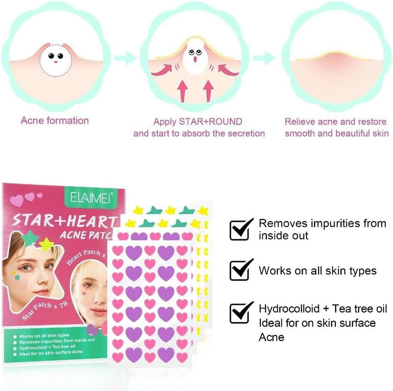 KANZA - 30 Pcs T-Zone Hydrocolloid Patches| Cleansing Blackhead Remover| Acne Patch Pimple Remover for Zit Breakouts |Nose and Forehead Patch |Painless,Safe |Removes Pimple,Acne Nose Gunk Pores