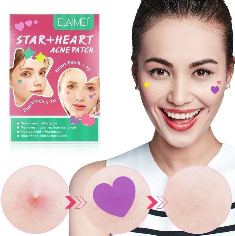 KANZA - 30 Pcs T-Zone Hydrocolloid Patches| Cleansing Blackhead Remover| Acne Patch Pimple Remover for Zit Breakouts |Nose and Forehead Patch |Painless,Safe |Removes Pimple,Acne Nose Gunk Pores