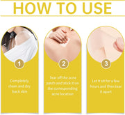Back Acne Patch, Large Salicylic Acid Acne Patch for Body and Back, 12PCS Big Pimple Patches for Zits, Breakouts and Blemishes