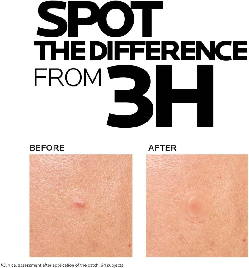 La Roche Posay Effaclar Duo+M 3H Spot Patches for Acne Prone Skin
