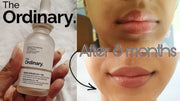 Alpha Arbutin 2% + HA - 30 ml