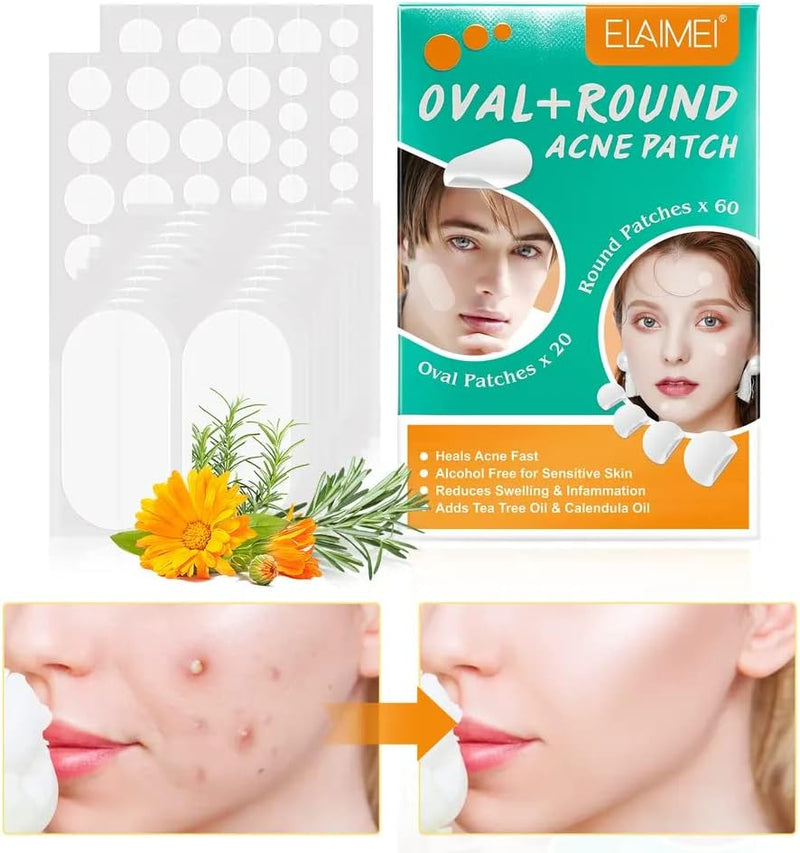 KANZA - 30 Pcs T-Zone Hydrocolloid Patches| Cleansing Blackhead Remover| Acne Patch Pimple Remover for Zit Breakouts |Nose and Forehead Patch |Painless,Safe |Removes Pimple,Acne Nose Gunk Pores
