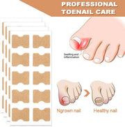 Multi-Purpose Nail Repair Patches 50Pcs, Nail Repair Toenail Treatment for Nail Fungus Damage, 8-Hour Treatment Restores Healthy Appearance