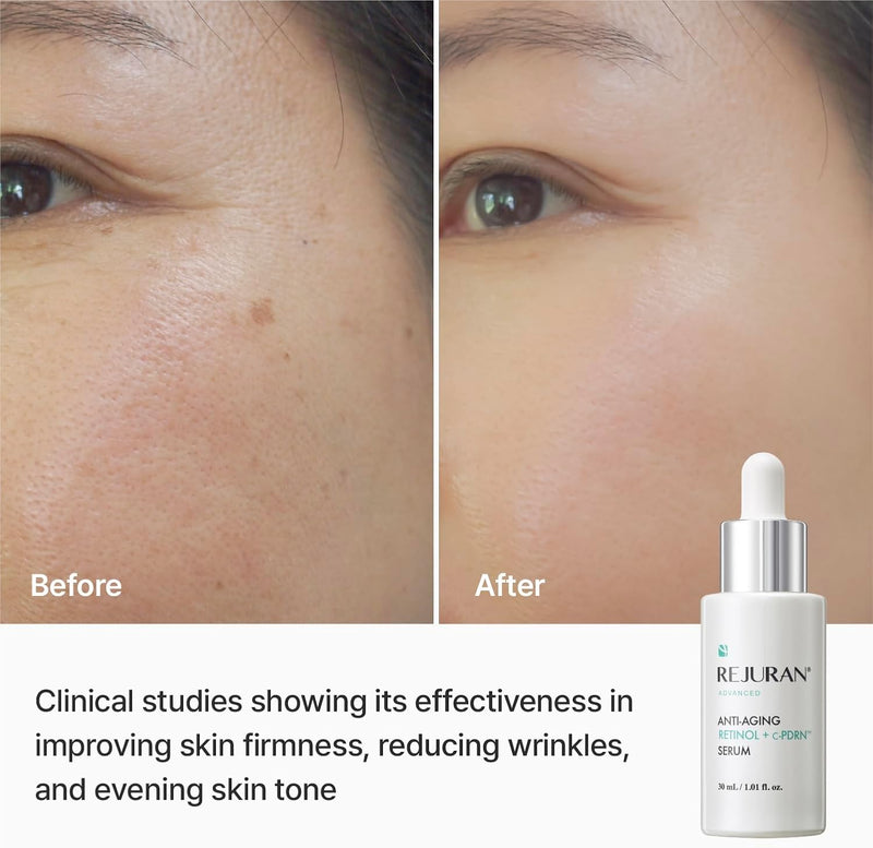 Advanced Anti-Aging Retinol + c-PDRN Serum for Face and Neck Triple Action with c-PDRN, Retinol, and Peptides