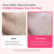 Dr.Melaxin Cemenrete Cyano Pinkspicule Serum 30ml