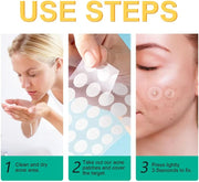 KANZA - 30 Pcs T-Zone Hydrocolloid Patches| Cleansing Blackhead Remover| Acne Patch Pimple Remover for Zit Breakouts |Nose and Forehead Patch |Painless,Safe |Removes Pimple,Acne Nose Gunk Pores