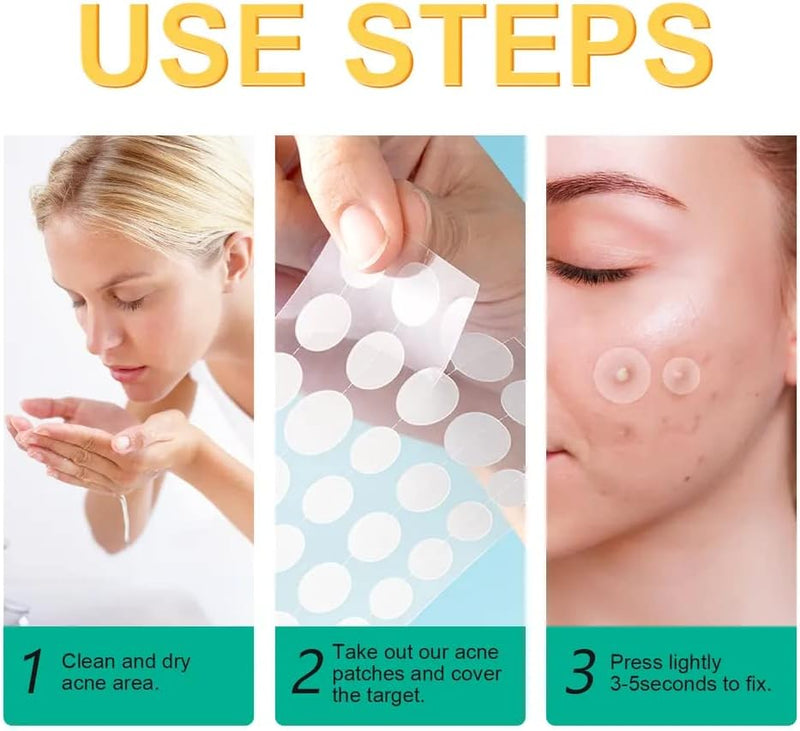 KANZA - 30 Pcs T-Zone Hydrocolloid Patches| Cleansing Blackhead Remover| Acne Patch Pimple Remover for Zit Breakouts |Nose and Forehead Patch |Painless,Safe |Removes Pimple,Acne Nose Gunk Pores