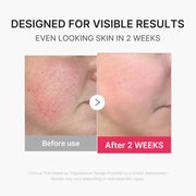 Mini Booster Pro Plus Facial Device for Radiant, Calming, and Bouncy-Looking Skin Red, Blue, Purple 3-Mode Portable Korean Skincare Device, At Home Care Pink