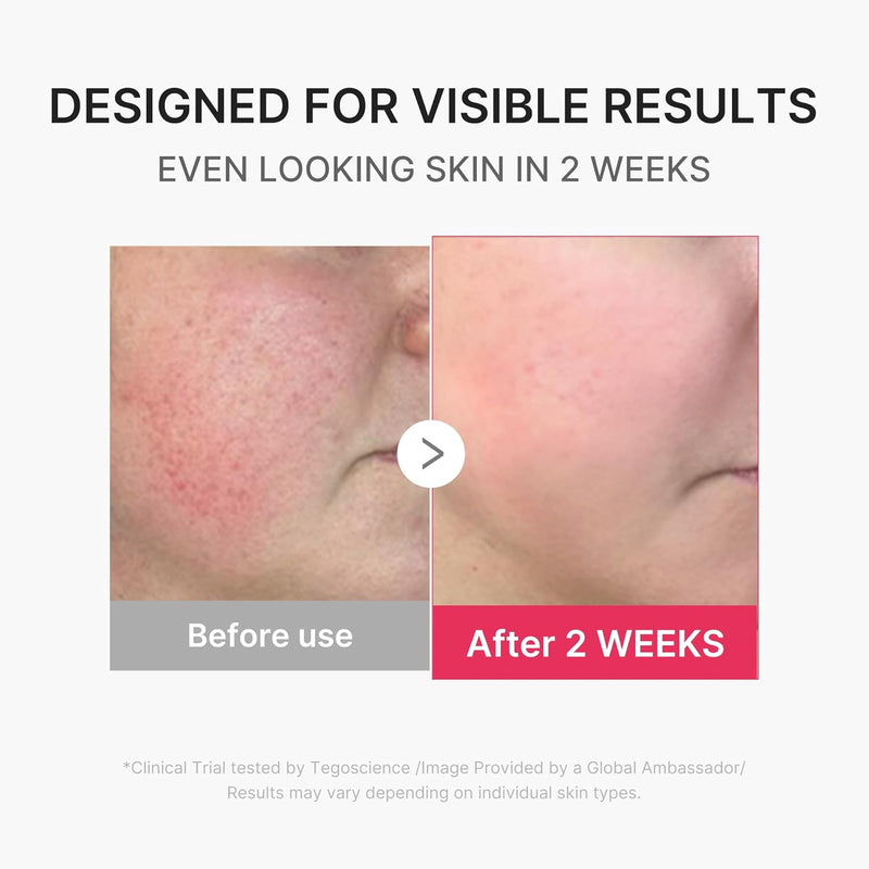 Mini Booster Pro Plus Facial Device for Radiant, Calming, and Bouncy-Looking Skin Red, Blue, Purple 3-Mode Portable Korean Skincare Device, At Home Care Pink