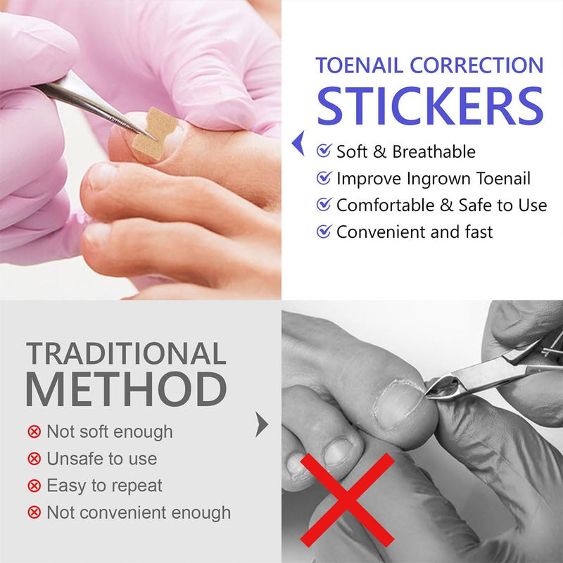 Multi-Purpose Nail Repair Patches 50Pcs, Nail Repair Toenail Treatment for Nail Fungus Damage, 8-Hour Treatment Restores Healthy Appearance