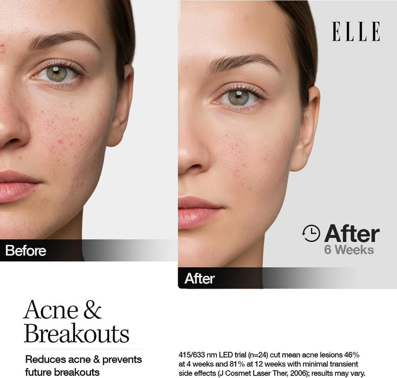 ELLE Radiance Boost Pro LED Face Mask FDA Approved & Clinically Proven Light Therapy for Glowing, Youthful Skin Red, Blue & Infrared Light Boosts Collagen, Reduce Wrinkles, Breakouts & Blemishes