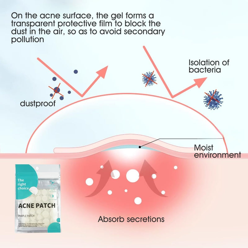 Vavilente Acne Pimple Patches,Hydrocolloid Acne Patch for Covering Face, Blemishes, Zits Absorbing Patch,Cosmetics Patch for Pimple Dots, Acne Treatment, Invisible Acne Spot Patches(150 Count)