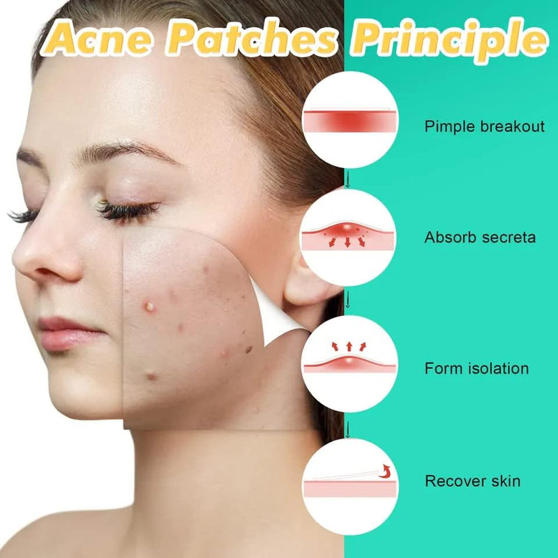 KANZA - 30 Pcs T-Zone Hydrocolloid Patches| Cleansing Blackhead Remover| Acne Patch Pimple Remover for Zit Breakouts |Nose and Forehead Patch |Painless,Safe |Removes Pimple,Acne Nose Gunk Pores