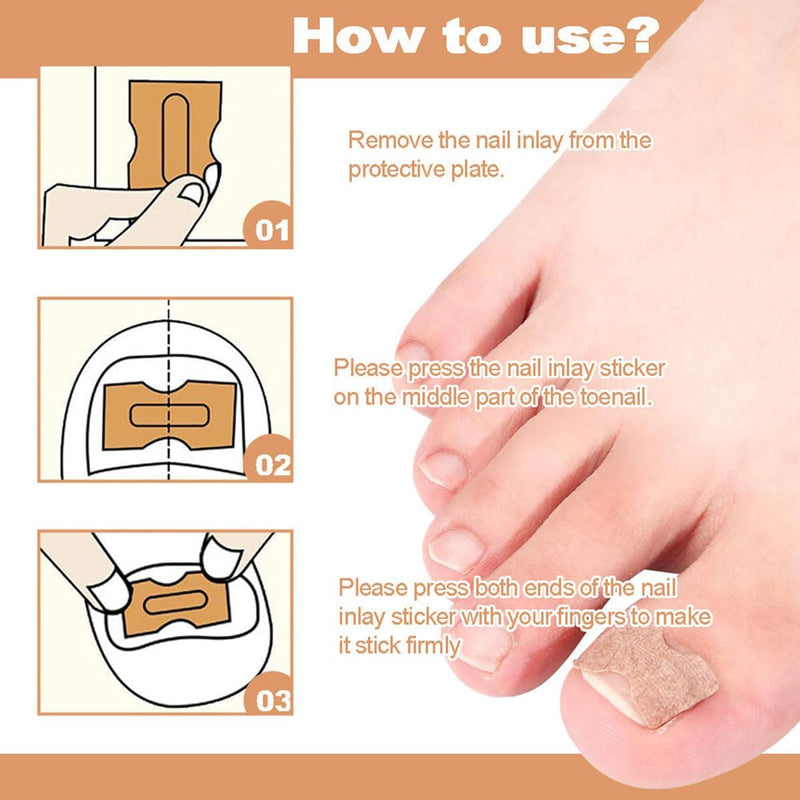 Multi-Purpose Nail Repair Patches 50Pcs, Nail Repair Toenail Treatment for Nail Fungus Damage, 8-Hour Treatment Restores Healthy Appearance