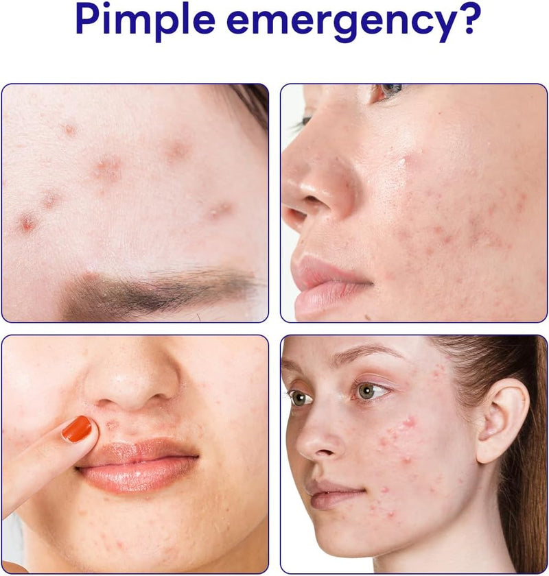 MEDIHEAL Derma Clear Madecassoside Blemish Patch (44 Counts) - Acne Spot Protection, Fast Healing with Madecassoside & Niacinamide