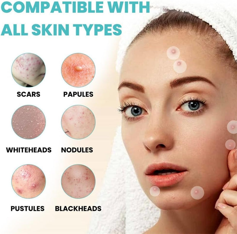 TERRIFI Pimple Patches for Face, 300 Hydrocolloid Patches, Effectively Cover and Repair Acne and Blemishes, Promote Skin Regeneration, Ideal for Makeup and Skincare