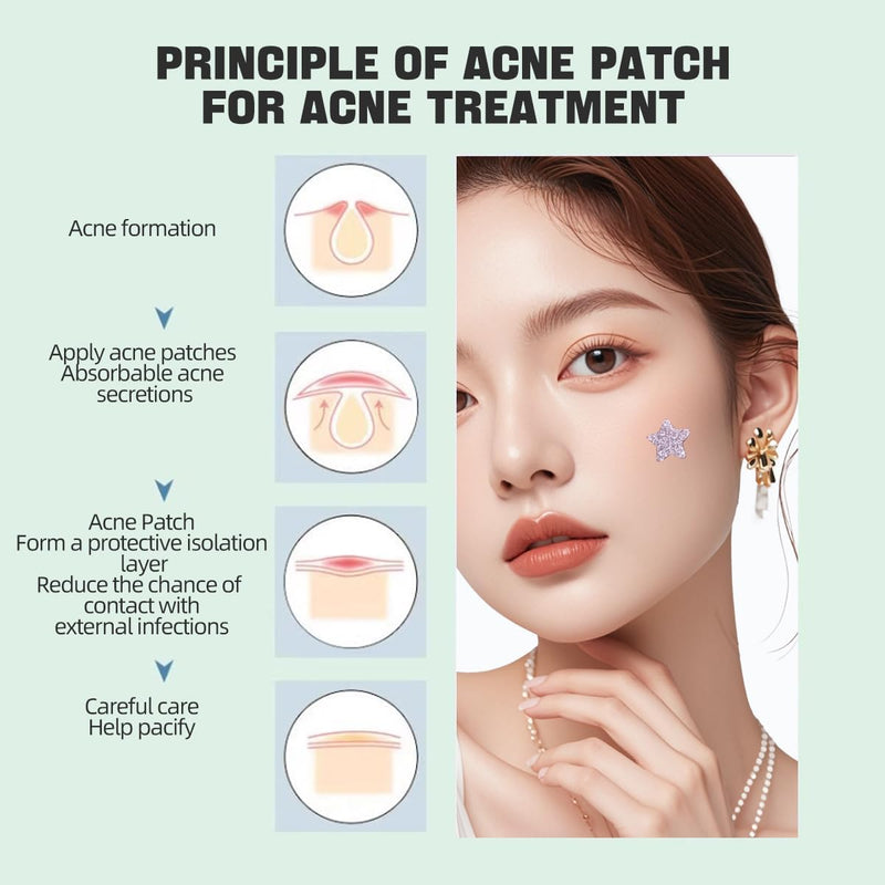 Vavilente Star Pimple Patches For Face,Cute Hydrocolloid Acne Patches,Mighty Patch,Fun Zit Stars Cover,Tea Tree Oil Pimple Stickers(200 Count)