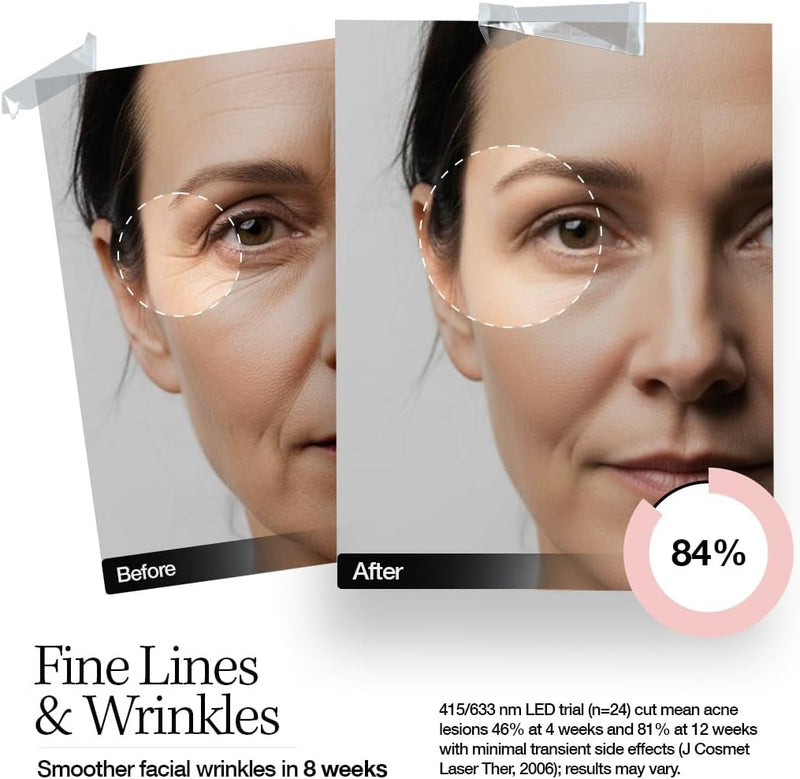 ELLE Radiance Boost Pro LED Face Mask FDA Approved & Clinically Proven Light Therapy for Glowing, Youthful Skin Red, Blue & Infrared Light Boosts Collagen, Reduce Wrinkles, Breakouts & Blemishes