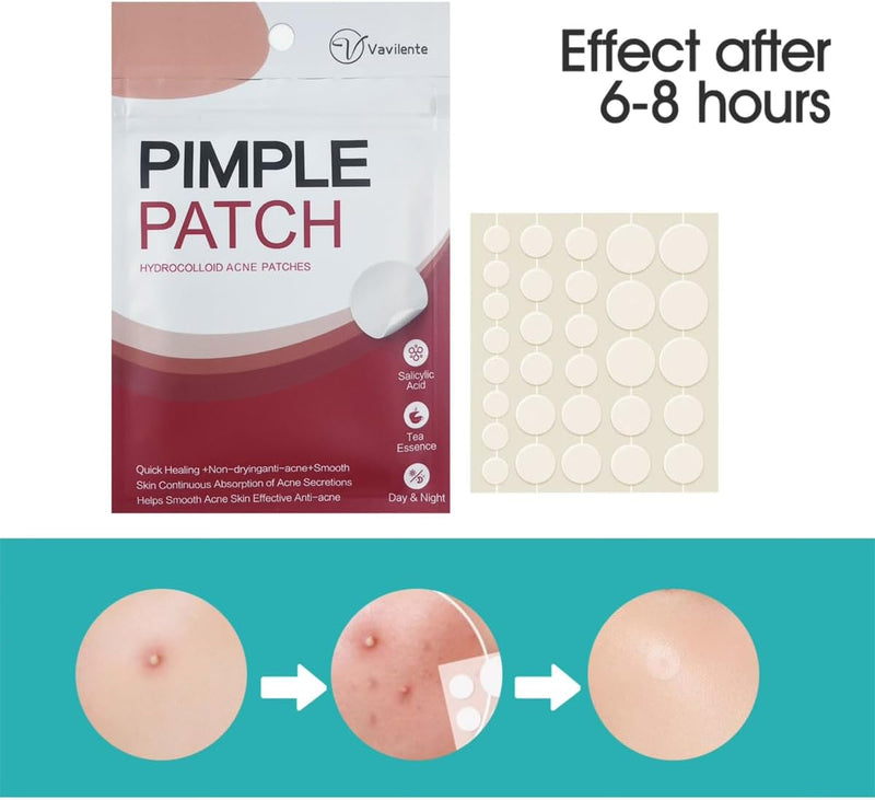 Vavilente Acne Pimple Patches,Hydrocolloid Acne Patch for Face, Pimple Patch for Zits And Blemishes,Mighty Patch,Pimple Stickers with Salicylic Acid, Tea Tree Oil & Calendula Oil(180 Count)