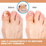 Multi-Purpose Nail Repair Patches 50Pcs, Nail Repair Toenail Treatment for Nail Fungus Damage, 8-Hour Treatment Restores Healthy Appearance